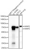 Western blot analysis of various lysates, using MMP2 Rabbit mAb (CAB23496) at 1:1000 dilution. Secondary antibody: HRP Goat Anti-Rabbit IgG (H+L) at 1:10000 dilution. Lysates/proteins: 25μg per lane. Blocking buffer: 3% nonfat dry milk in TBST.