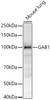Western blot analysis of Mouse lung, using GAB1 Rabbit mAb (CAB23499) at 1:1000 dilution. Secondary antibody: HRP Goat Anti-Rabbit IgG (H+L) at 1:10000 dilution. Lysates/proteins: 25μg per lane. Blocking buffer: 3% nonfat dry milk in TBST.