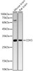 Western blot analysis of various lysates, using CDK5 antibody (CAB23502) at1:2000 dilution. Secondary antibody: HRP Goat Anti-Rabbit IgG (H+L) at 1:10000 dilution. Lysates/proteins: 25μg per lane. Blocking buffer: 3% nonfat dry milk in TBST.