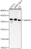 Western blot analysis of various lysates, using ABHD6 Rabbit pAb (CAB23526) at 1:500 dilution. Secondary antibody: HRP Goat Anti-Rabbit IgG (H+L) at 1:10000 dilution. Lysates/proteins: 25ug per lane. Blocking buffer: 3% nonfat dry milk in TBST.