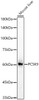Western blot analysis of Mouse liver, using PCSK9 Rabbit pAb (CAB23546) at 1:1000 dilution. Secondary antibody: HRP Goat Anti-Rabbit IgG (H+L) at 1:10000 dilution. Lysates/proteins: 25μg per lane. Blocking buffer: 3% nonfat dry milk in TBST.