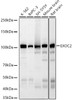 Western blot analysis of various lysates, using EXOC2 Rabbit mAb (CAB23562) at 1:400 dilution. Secondary antibody: HRP Goat Anti-Rabbit IgG (H+L) at 1:10000 dilution. Lysates/proteins: 25μg per lane. Blocking buffer: 3% nonfat dry milk in TBST.