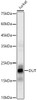 Western blot analysis of Jurkat, using DUT Rabbit mAb (CAB23563) at 1:800 dilution. Secondary antibody: HRP Goat Anti-Rabbit IgG (H+L) at 1:10000 dilution. Lysates/proteins: 25μg per lane. Blocking buffer: 3% nonfat dry milk in TBST.