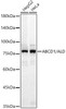 Western blot analysis of various lysates, using ABCD1/ALD Rabbit mAb (CAB23569) at 1:1000 dilution. Secondary antibody: HRP Goat Anti-Rabbit IgG (H+L) at 1:10000 dilution. Lysates/proteins: 25μg per lane. Blocking buffer: 3% nonfat dry milk in TBST.