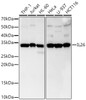 Western blot analysis of various lysates, using IL26 Rabbit mAb (CAB23576) at 1:1000 dilution. Secondary antibody: HRP Goat Anti-Rabbit IgG (H+L) at 1:10000 dilution. Lysates/proteins: 25μg per lane. Blocking buffer: 3% nonfat dry milk in TBST.