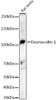 Western blot analysis of Rat testis, using Desmocollin 1 Rabbit mAb (CAB23580) at 1:1000 dilution. Secondary antibody: HRP Goat Anti-Rabbit IgG (H+L) at 1:10000 dilution. Lysates/proteins: 25μg per lane. Blocking buffer: 3% nonfat dry milk in TBST.