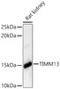 Western blot analysis of Rat kidney, using TIMM13 Rabbit pAb (CAB23597) at 1:4000 dilution. Secondary antibody: HRP Goat Anti-Rabbit IgG (H+L) at 1:10000 dilution. Lysates/proteins: 25μg per lane. Blocking buffer: 3% nonfat dry milk in TBST.