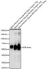 Western blot analysis of Recombinant Mouse IFN-beta Protein(RP01076，C-hFc&His taged), using IFN-beta Rabbit pAb (CAB23651) at 1:2000 dilution. Secondary antibody: HRP Goat Anti-Rabbit IgG (H+L) at 1:10000 dilution. Lysates/proteins: 25μg per lane. Blocking buffer: 3% nonfat dry milk in TBST.