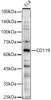 Western blot analysis of EL4, using CD119 Rabbit pAb (CAB23652) at 1:3000 dilution. Secondary antibody: HRP Goat Anti-Rabbit IgG (H+L) at 1:10000 dilution. Lysates/proteins: 25μg per lane. Blocking buffer: 3% nonfat dry milk in TBST.
