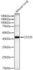 Western blot analysis of Mouse lung, using CD335 Rabbit pAb (CAB23655) at 1:500 dilution. Secondary antibody: HRP Goat Anti-Rabbit IgG (H+L) at 1:10000 dilution. Lysates/proteins: 25ug per lane. Blocking buffer: 3% nonfat dry milk in TBST.