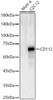 Western blot analysis of various lysates, using CD112 Rabbit pAb (CAB23657) at 1:2000 dilution. Secondary antibody: HRP Goat Anti-Rabbit IgG (H+L) at 1:10000 dilution. Lysates/proteins: 25μg per lane. Blocking buffer: 3% nonfat dry milk in TBST.