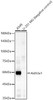 Western blot analysis of various lysates, using Aldh3a1 Rabbit pAb (CAB23660) at 1:3000 dilution. Secondary antibody: HRP Goat Anti-Rabbit IgG (H+L) at 1:10000 dilution. Lysates/proteins: 25ug per lane. Blocking buffer: 3% nonfat dry milk in TBST.