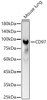 Western blot analysis of Mouse lung, using CD97 Rabbit pAb (CAB23662) at 1:1000 dilution. Secondary antibody: HRP Goat Anti-Rabbit IgG (H+L) at 1:10000 dilution. Lysates/proteins: 25μg per lane. Blocking buffer: 3% nonfat dry milk in TBST.