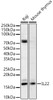 Western blot analysis of various lysates, using IL22 Rabbit pAb (CAB23665) at 1:1000 dilution. Secondary antibody: HRP Goat Anti-Rabbit IgG (H+L) at 1:10000 dilution. Lysates/proteins: 25μg per lane. Blocking buffer: 3% nonfat dry milk in TBST.