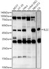 Western blot analysis of various lysates, using IL22 Rabbit pAb (CAB23667) at 1:3000 dilution. Secondary antibody: HRP Goat Anti-Rabbit IgG (H+L) at 1:10000 dilution. Lysates/proteins: 25μg per lane. Blocking buffer: 3% nonfat dry milk in TBST.