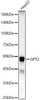 Western blot analysis of HepG2, using GPT2 Rabbit pAb (CAB23670) at 1:1000 dilution. Secondary antibody: HRP Goat Anti-Rabbit IgG (H+L) at 1:10000 dilution. Lysates/proteins: 25μg per lane. Blocking buffer: 3% nonfat dry milk in TBST.