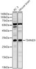Western blot analysis of various lysates, using TIMM29 Rabbit pAb (CAB23671) at 1:500 dilution. Secondary antibody: HRP Goat Anti-Rabbit IgG (H+L) at 1:10000 dilution. Lysates/proteins: 25ug per lane. Blocking buffer: 3% nonfat dry milk in TBST.