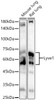 Western blot analysis of various lysates, using Lyve1 Rabbit pAb (CAB23673) at 1:1000 dilution. Secondary antibody: HRP Goat Anti-Rabbit IgG (H+L) at 1:10000 dilution. Lysates/proteins: 25μg per lane. Blocking buffer: 3% nonfat dry milk in TBST.