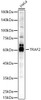 Western blot analysis of HeLa, using [KO Validated] TRAF2 Rabbit pAb (CAB23680) at 1:400 dilution. Secondary antibody: HRP Goat Anti-Rabbit IgG (H+L) at 1:10000 dilution. Lysates/proteins: 25μg per lane. Blocking buffer: 3% nonfat dry milk in TBST.
