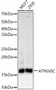 Western blot analysis of various lysates, using ATP6V0C Rabbit mAb (CAB23757) at 1:1000 dilution. Secondary antibody: HRP Goat Anti-Rabbit IgG (H+L) at 1:10000 dilution. Lysates/proteins: 25μg per lane. Blocking buffer: 3% nonfat dry milk in TBST.