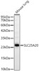 Western blot analysis of Mouse lung, using SLC25A20 Rabbit mAb (CAB23763) at 1:1000 dilution. Secondary antibody: HRP Goat Anti-Rabbit IgG (H+L) at 1:10000 dilution. Lysates/proteins: 25μg per lane. Blocking buffer: 3% nonfat dry milk in TBST.