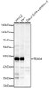 Western blot analysis of various lysates, using TEAD4 Rabbit mAb (CAB23774) at 1:1000 dilution. Secondary antibody: HRP Goat Anti-Rabbit IgG (H+L) at 1:10000 dilution. Lysates/proteins: 25μg per lane. Blocking buffer: 3% nonfat dry milk in TBST.