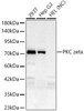 Western blot analysis of various lysates, using PKC zeta Rabbit mAb (CAB23777) at 1:1000 dilution. Secondary antibody: HRP Goat Anti-Rabbit IgG (H+L) at 1:10000 dilution. Lysates/proteins: 25μg per lane. Blocking buffer: 3% nonfat dry milk in TBST.