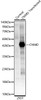Western blot analysis of normal 293T cells and 293T transfected with CNMD protein, using CNMD Rabbit pAb (CAB23878) at 1:1000 dilution. Secondary antibody: HRP Goat Anti-Rabbit IgG (H+L) at 1:10000 dilution. Lysates/proteins: 25ug per lane. Blocking buffer: 3% nonfat dry milk in TBST.