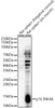 Western blot analysis of various lysates, using p16 INK4A Rabbit pAb (CAB23882) at 1:1000 dilution. Secondary antibody: HRP Goat Anti-Rabbit IgG (H+L) at 1:10000 dilution. Lysates/proteins: 25ug per lane. Blocking buffer: 3% nonfat dry milk in TBST.