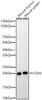 Western blot analysis of various lysates, using CD3d Rabbit pAb (CAB23883) at 1:400 dilution. Secondary antibody: HRP Goat Anti-Rabbit IgG (H+L) at 1:10000 dilution. Lysates/proteins: 25ug per lane. Blocking buffer: 3% nonfat dry milk in TBST.