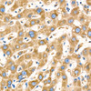 Immunohistochemistry analysis of paraffin-embedded human liver using MTDH Rabbit mAb (CAB23911) at dilution of 1:300 (40x lens). Perform high pressure antigen retrieval with 10 mM citrate buffer pH 6. 0 before commencing with IHC staining protocol.