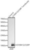 Western blot analysis of 293F and S100A12/CGRP 293F trasfected cells, using S100A12/CGRP Rabbit mAb (CAB23912) at 1:1000 dilution. Secondary antibody: HRP Goat Anti-Rabbit IgG (H+L) at 1:10000 dilution. Lysates/proteins: 25μg per lane. Blocking buffer: 3% nonfat dry milk in TBST.