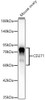 Western blot analysis of Mouse ovary, using CD271 Rabbit mAb (CAB23913) at 1:1000 dilution. Secondary antibody: HRP Goat Anti-Rabbit IgG (H+L) at 1:10000 dilution. Lysates/proteins: 25μg per lane. Blocking buffer: 3% nonfat dry milk in TBST.