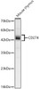 Western blot analysis of Mouse thymus, using CD274 Rabbit mAb (CAB23922) at 1:1000 dilution. Secondary antibody: HRP Goat Anti-Rabbit IgG (H+L) at 1:10000 dilution. Lysates/proteins: 25μg per lane. Blocking buffer: 3% nonfat dry milk in TBST.