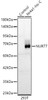 Western blot analysis of extracts of normal 293T cells and 293T transfected with 293T-Nr4a1-His protein, using NUR77 Rabbit pAb (CAB23940) at 1:400 dilution. Secondary antibody: HRP Goat Anti-Rabbit IgG (H+L) at 1:10000 dilution. Lysates/proteins: 25ug per lane. Blocking buffer: 3% nonfat dry milk in TBST.