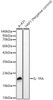 Western blot analysis of various lysates, using IL-1RA Rabbit mAb (CAB23956) at 1:2000 dilution. Secondary antibody: HRP Goat Anti-Rabbit IgG (H+L) at 1:10000 dilution. Lysates/proteins: 25ug per lane. Blocking buffer: 3% nonfat dry milk in TBST.