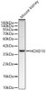 Western blot analysis of Mouse kidney, using HOXD10 Rabbit mAb (CAB23992) at 1:1000 dilution. Secondary antibody: HRP Goat Anti-Rabbit IgG (H+L) at 1:10000 dilution. Lysates/proteins: 25ug per lane. Blocking buffer: 3% nonfat dry milk in TBST.