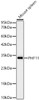 Western blot analysis of Mouse spleen, using PHF11 Rabbit mAb (CAB23994) at 1:2000 dilution. Secondary antibody: HRP Goat Anti-Rabbit IgG (H+L) at 1:10000 dilution. Lysates/proteins: 25ug per lane. Blocking buffer: 3% nonfat dry milk in TBST.