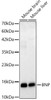 Western blot analysis of various lysates, using BNP Rabbit mAb (CAB23996) at 1:1000 dilution. Secondary antibody: HRP Goat Anti-Rabbit IgG (H+L) at 1:10000 dilution. Lysates/proteins: 25ug per lane. Blocking buffer: 3% nonfat dry milk in TBST.