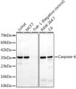 Western blot analysis of various lysates, using Caspase-6 Rabbit mAb (CAB24004) at 1:1000 dilution. Secondary antibody: HRP Goat Anti-Rabbit IgG (H+L) at 1:10000 dilutionLysates/proteins: 25μg per lane. Blocking buffer: 3% nonfat dry milk in TBST.