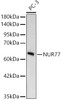 Western blot analysis of PC-3, using NUR77 Rabbit mAb (CAB24016) at 1:1000 dilution. Secondary antibody: HRP Goat Anti-Rabbit IgG (H+L) at 1:10000 dilution. Lysates/proteins: 25ug per lane. Blocking buffer: 3% nonfat dry milk in TBST.