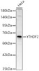 Western blot analysis of HeLa, using YTHDF2 Rabbit pAb (CAB24287) at 1:1000 dilution. Secondary antibody: HRP Goat Anti-Rabbit IgG (H+L) at 1:10000 dilution. Lysates/proteins: 25ug per lane. Blocking buffer: 3% nonfat dry milk in TBST.