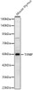 Western blot analysis of Mouse thymus, using TXNIP Rabbit pAb (CAB24289) at 1:2000 dilution. Secondary antibody: HRP Goat Anti-Rabbit IgG (H+L) at 1:10000 dilution. Lysates/proteins: 25ug per lane. Blocking buffer: 3% nonfat dry milk in TBST.
