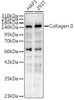 Western blot analysis of extracts of various cell lines, using Collagen II Rabbit pAb (CAB24334) at 1:400 dilution. Secondary antibody: HRP Goat Anti-Rabbit IgG (H+L) at 1:10000 dilution. Lysates/proteins: 25ug per lane. Blocking buffer: 3% nonfat dry milk in TBST.
