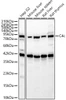 Western blot analysis of various lysates, using C4c Rabbit pAb (CAB24351) at 1:2000 dilution. Secondary antibody: HRP Goat Anti-Rabbit IgG (H+L) at 1:10000 dilution. Lysates/proteins: 25ug per lane. Blocking buffer: 3% nonfat dry milk in TBST.