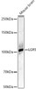 Western blot analysis of Mouse brain, using LGR5 Rabbit pAb (CAB24460) at 1:2000 dilution. Secondary antibody: HRP Goat Anti-Rabbit IgG (H+L) at 1:10000 dilution. Lysates/proteins: 25ug per lane. Blocking buffer: 3% nonfat dry milk in TBST.