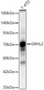 Western blot analysis of T-47D, using GRHL2 Rabbit pAb (CAB24468) at 1:1000 dilution. Secondary antibody: HRP Goat Anti-Rabbit IgG (H+L) at 1:10000 dilution. Lysates/proteins: 25ug per lane. Blocking buffer: 3% nonfat dry milk in TBST.
