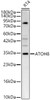 Western blot analysis of RT4, using ATOH8 Rabbit pAb (CAB24470) at 1:1000 dilution. Secondary antibody: HRP Goat Anti-Rabbit IgG (H+L) at 1:10000 dilution. Lysates/proteins: 25ug per lane. Blocking buffer: 3% nonfat dry milk in TBST.