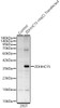 Western blot analysis of lysates from wild type (WT) and 293T cells transfected with ZDHHC15 Rabbit pAb, using ZDHHC15 Rabbit pAb (CAB24473) at 1:1000 dilution. Secondary antibody: HRP Goat Anti-Mouse IgG (H+L) (AS003) at 1:10000 dilution. Lysates/proteins: 25ug per lane. Blocking buffer: 3% nonfat dry milk in TBST.