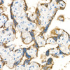 Immunohistochemistry analysis of paraffin-embedded human placenta using KISS1 Rabbit pAb (CAB24480) at dilution of 1:50 (40x lens). Perform high pressure antigen retrieval with 10 mM citrate buffer pH 6. 0 before commencing with IHC staining protocol.